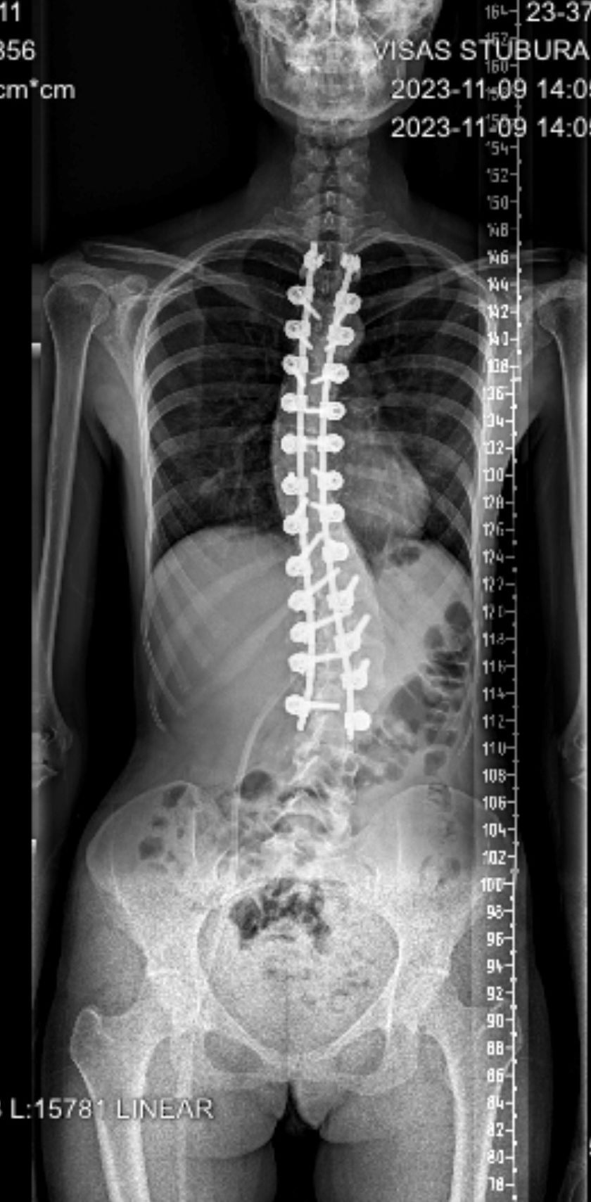 
Santaros klinikos tapo vienu iš referentinių EUROSPINE stuburo chirurgijos centrų Europoje                