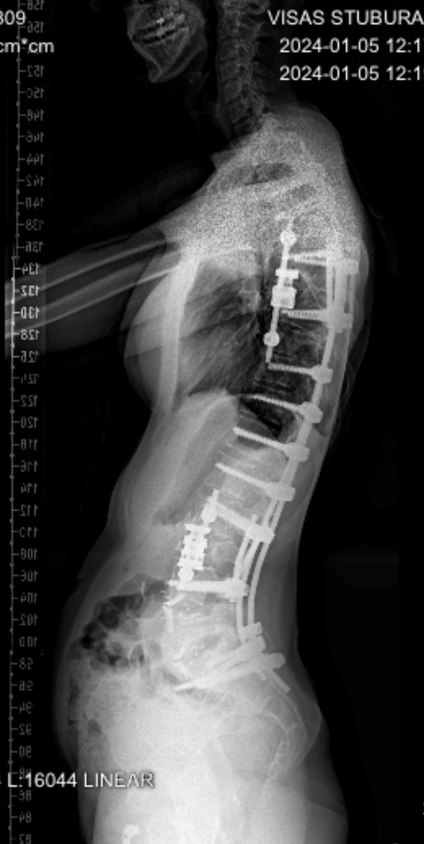 
Santaros klinikos tapo vienu iš referentinių EUROSPINE stuburo chirurgijos centrų Europoje                